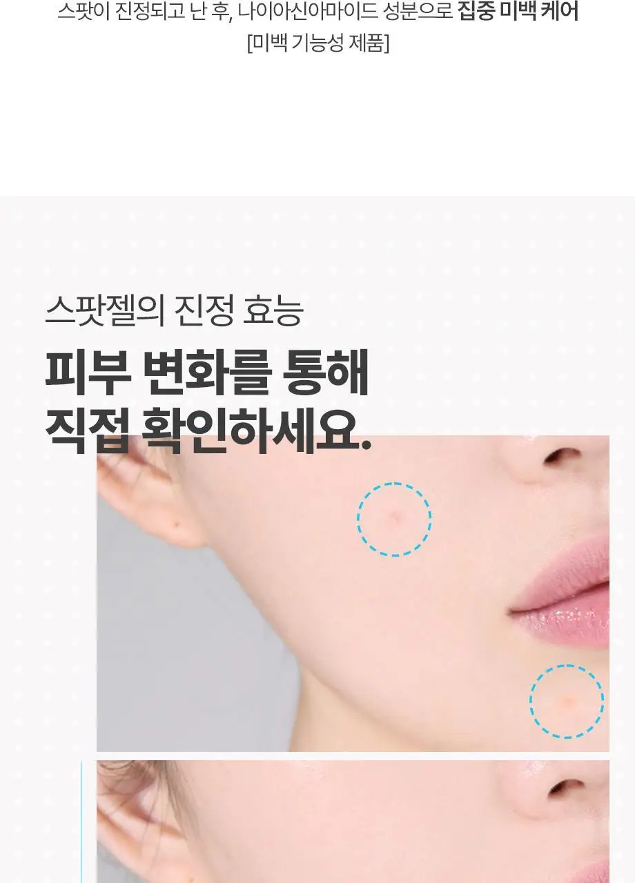 해서린 스팟케어 클리어 젤 15ml 상세페이지 10