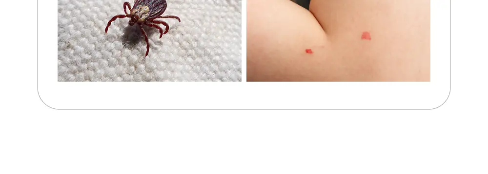 모키토 모기기피제 스프레이 80ml 상세페이지 17