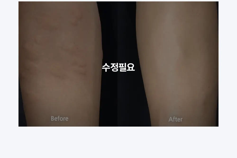 모키토 모키밤/스프레이/패치(S/L) 4종 상세페이지 29