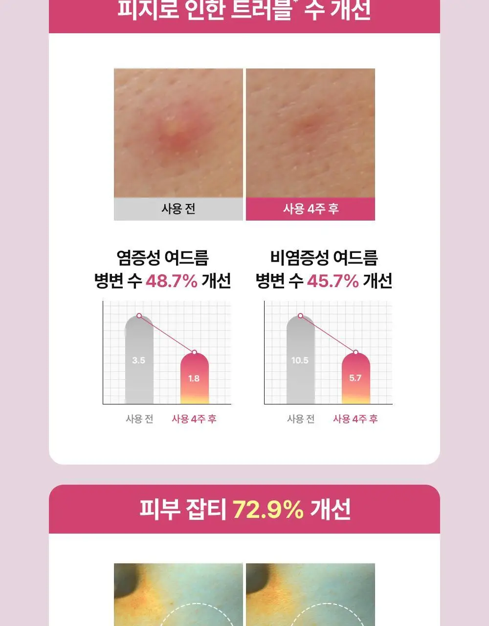 니들리 패치 포 블레미쉬스 컬러풀 12패치 상세페이지 17