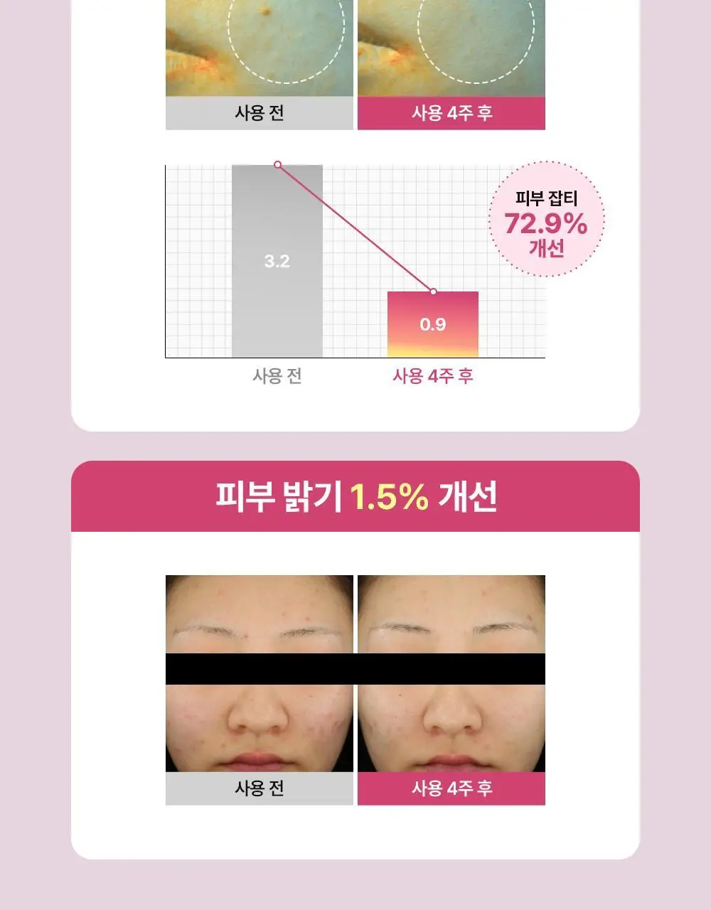 니들리 패치 포 블레미쉬스 컬러풀 12패치 상세페이지 18