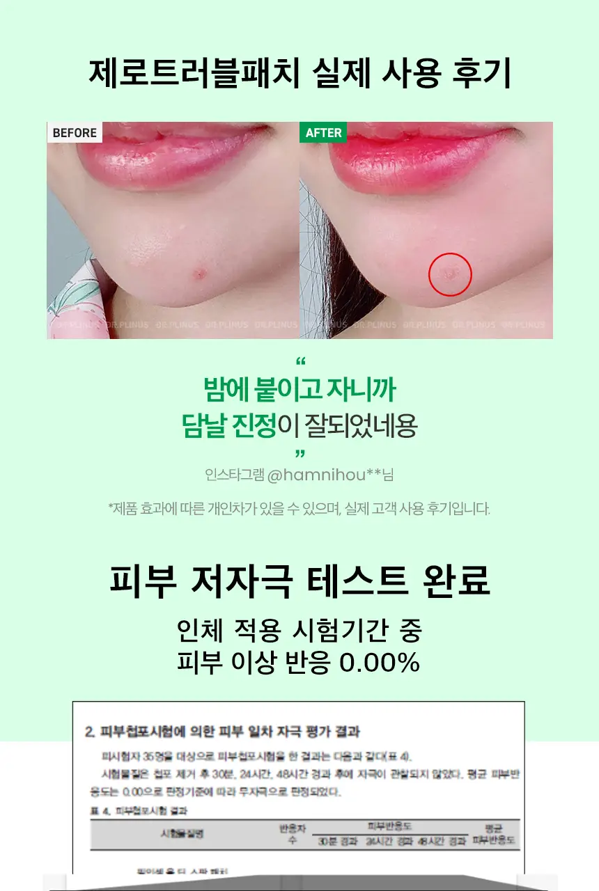 닥터플리너스 제로트러블패치 3팩 (27매) 상세페이지 11