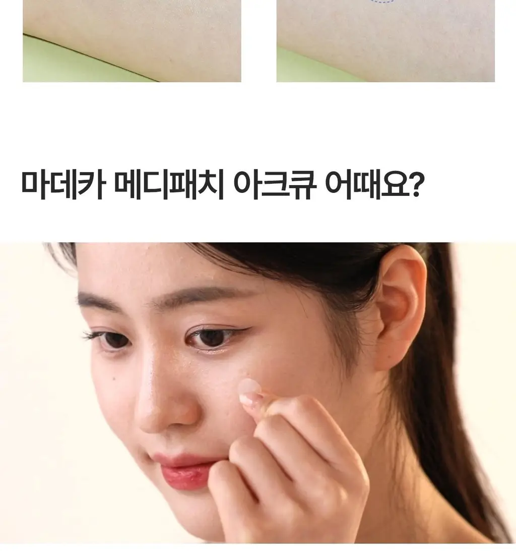 마데카 메디패치 아크큐 61매 1+1 기획(짜기전/낮케어) 상세페이지 19