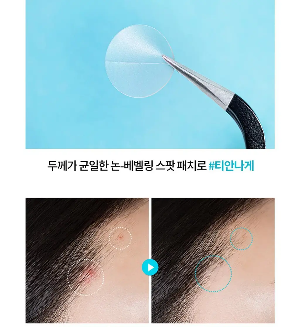 아크네스 3초 진정 올클리어 스팟패치 66매 상세페이지 3