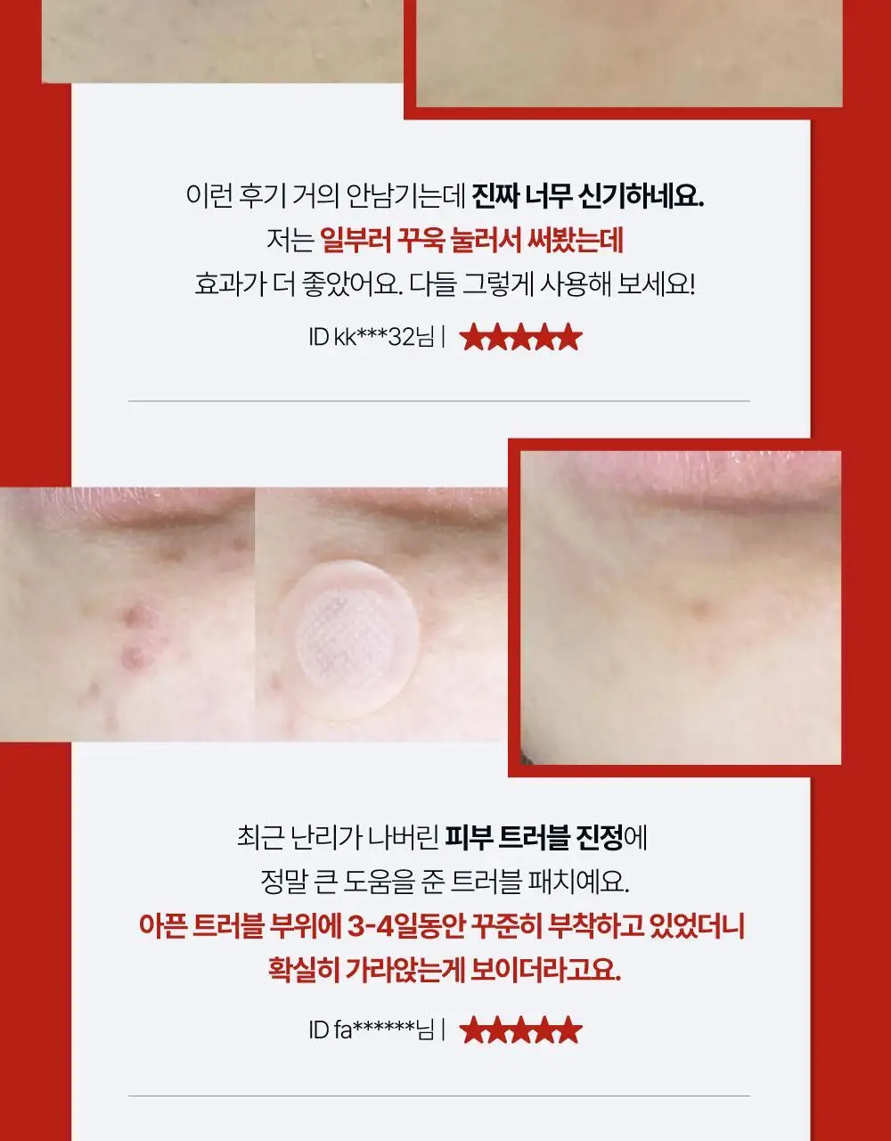 큐어시스 트러블 클리어패치 대용량 27매입 상세페이지 19