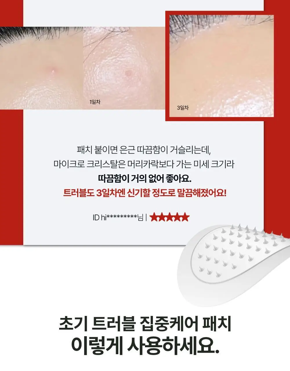 큐어시스 트러블 클리어패치 대용량 27매입 상세페이지 20