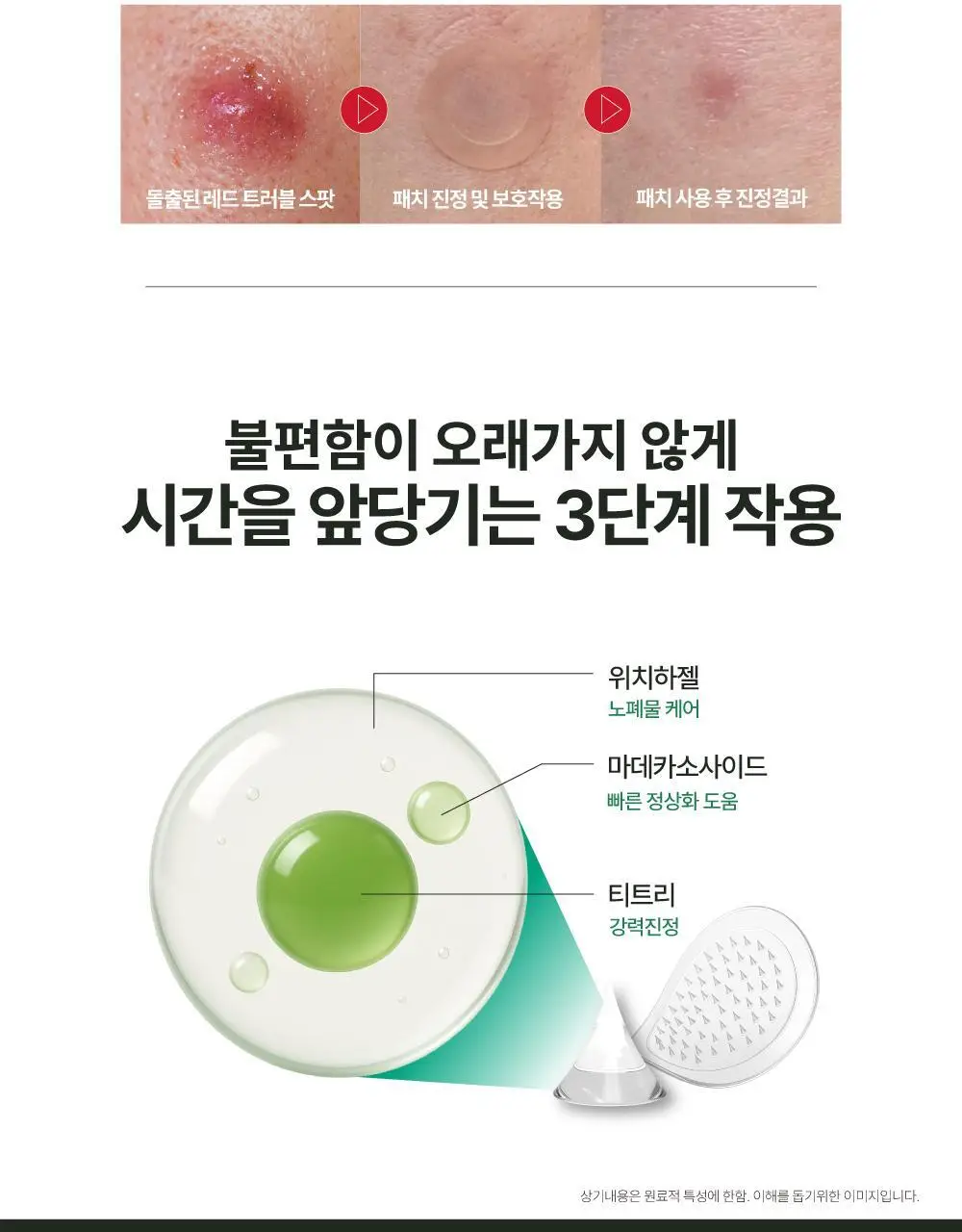 큐어시스 트러블 클리어패치 9매입 상세페이지 14