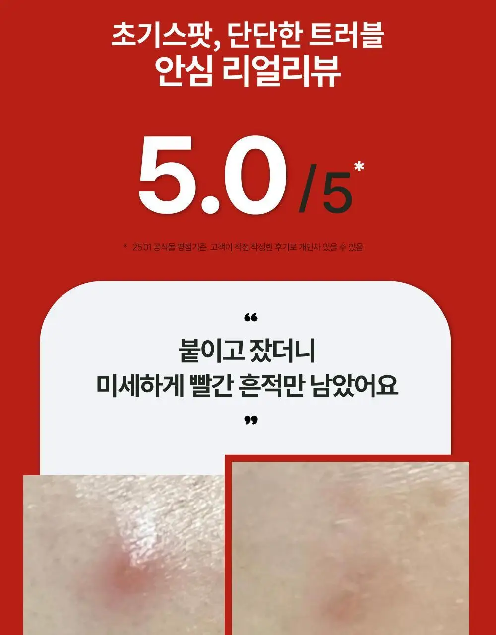 큐어시스 트러블 클리어패치 9매입 상세페이지 18