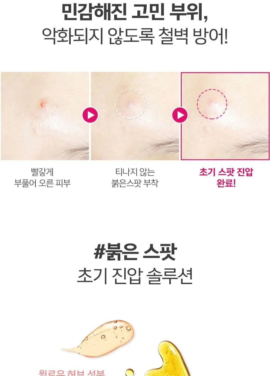 해서린 스팟케어 패치 4종 (패치140매/붉은스팟/노란스팟/젤) 상세페이지 9