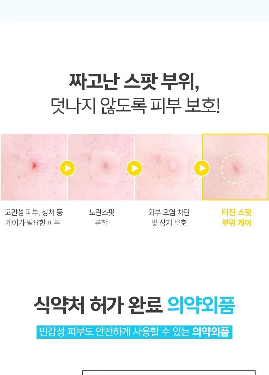 해서린 스팟케어 패치 4종 (패치140매/붉은스팟/노란스팟/젤) 상세페이지 11