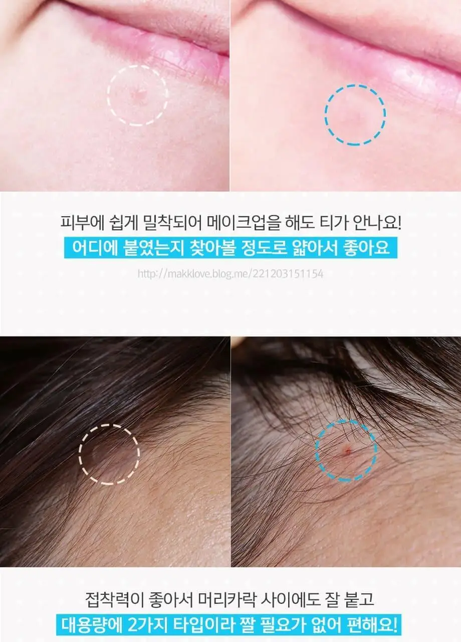 해서린 스팟케어 패치 4종 (패치140매/붉은스팟/노란스팟/젤) 상세페이지 15