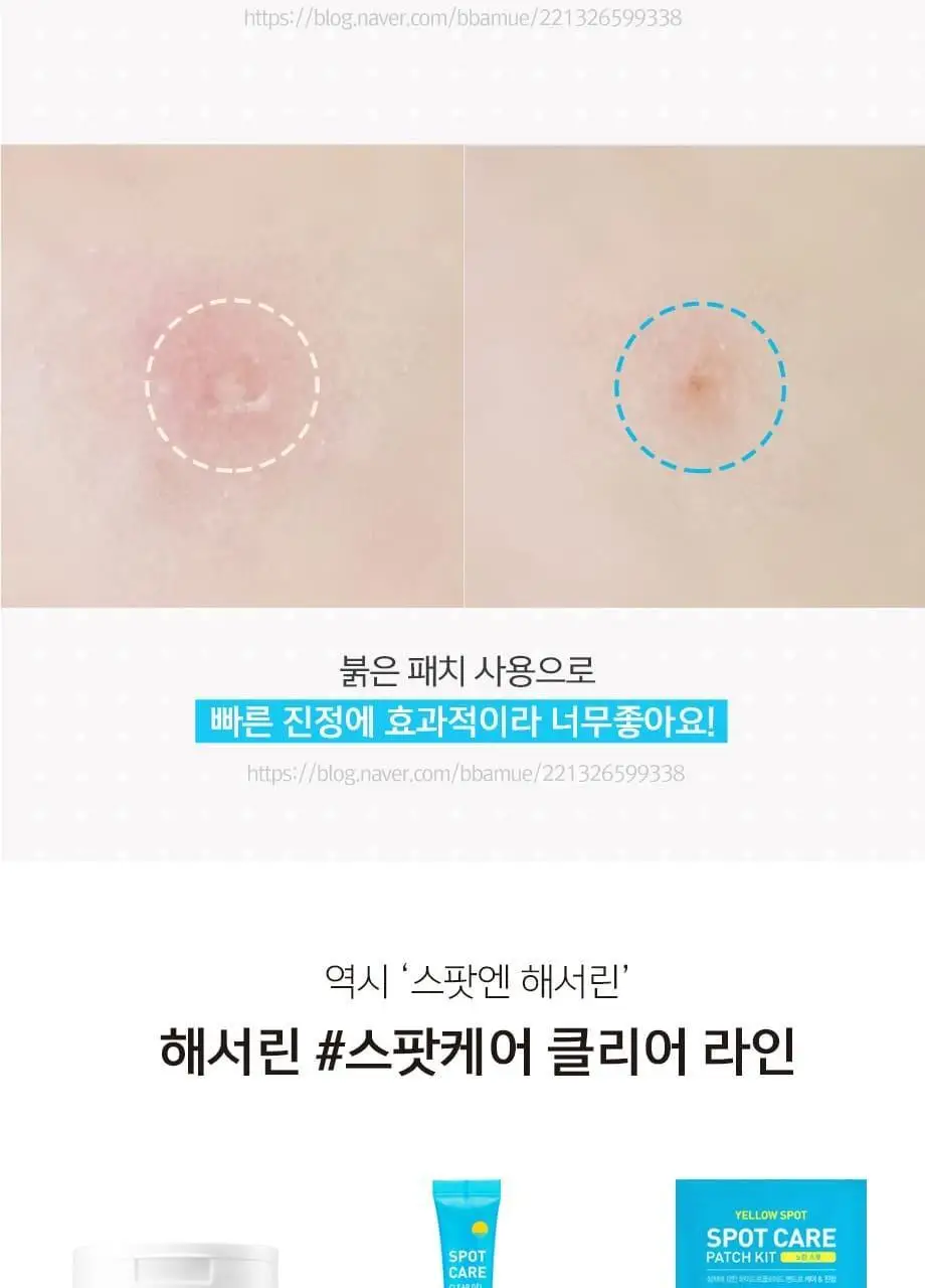 해서린 스팟케어 패치 4종 (패치140매/붉은스팟/노란스팟/젤) 상세페이지 16