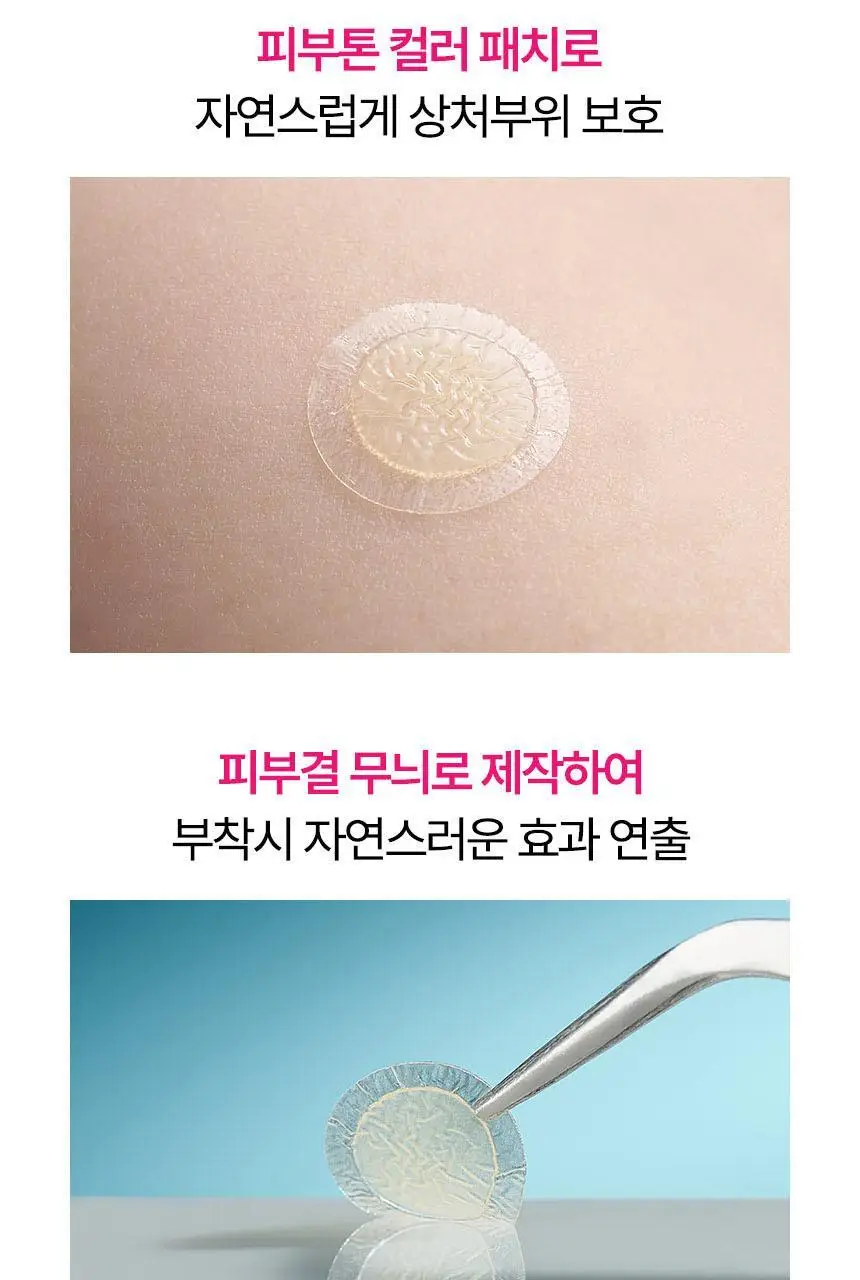 (의료기기) 듀오덤 스팟패치 72매 상세페이지 14