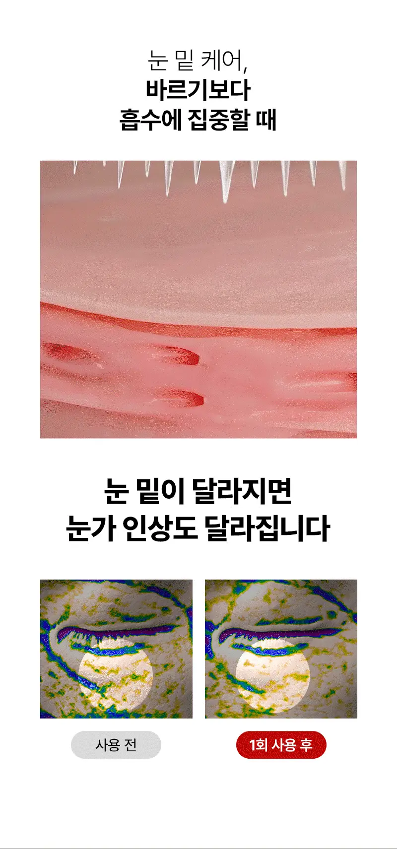 니들리 아이백 브라이트닝 2200샷 패치 상세페이지 5