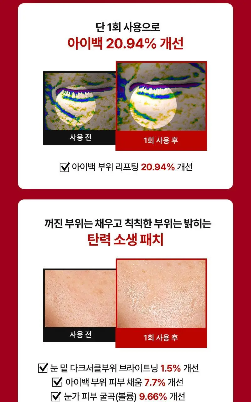 니들리 아이백 브라이트닝 2200샷 패치 상세페이지 20