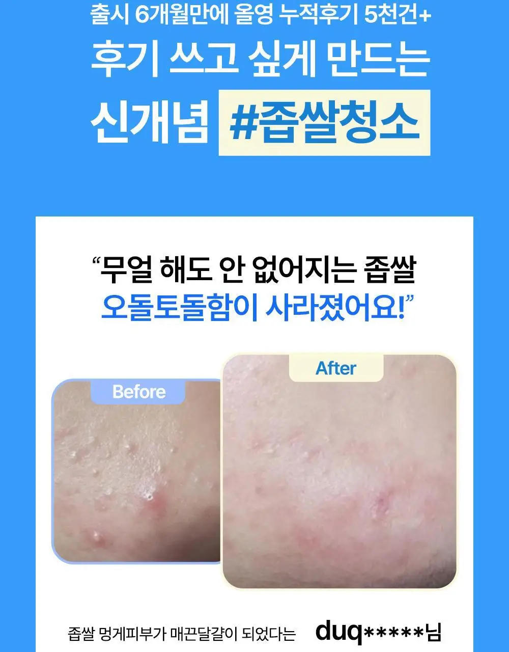 닥터웰메이드원 좁쌀피지 순삭패치 마일드 30매 상세페이지 3
