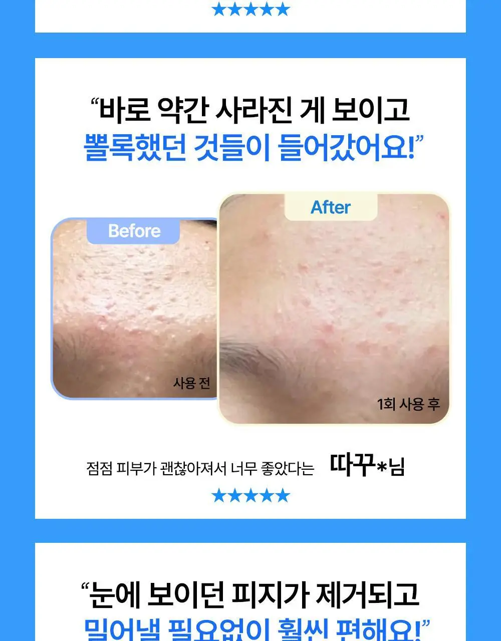 닥터웰메이드원 좁쌀피지 순삭패치 마일드 30매 상세페이지 4