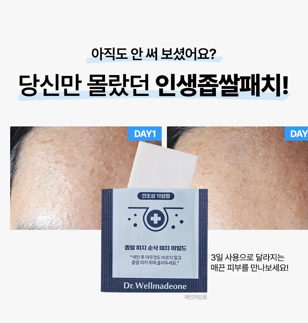 닥터웰메이드원 좁쌀피지 순삭패치 마일드 30매 상세페이지 7
