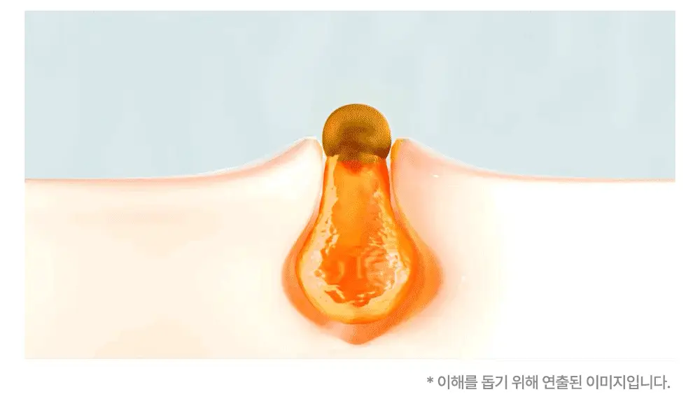 닥터웰메이드원 좁쌀피지 순삭패치 마일드 30매 상세페이지 26