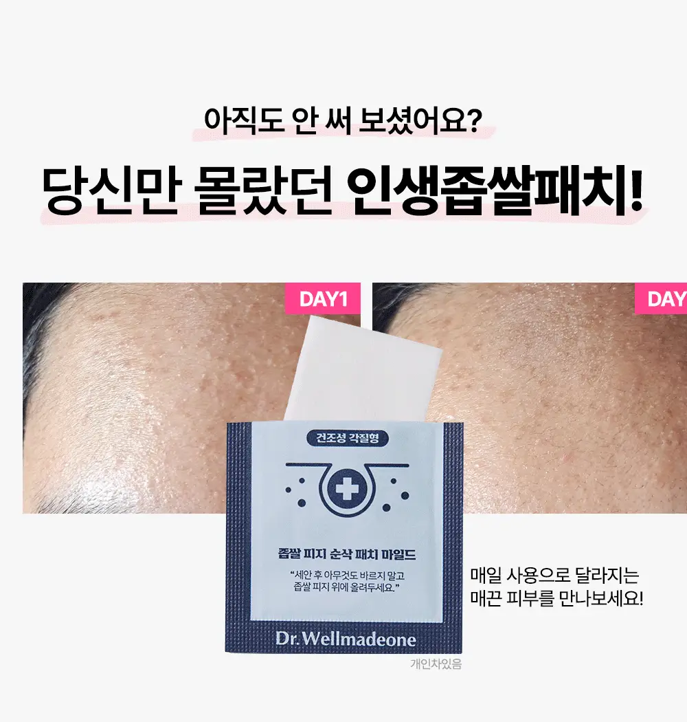 닥터웰메이드원 좁쌀피지 순삭패치 멀티팩 30매 상세페이지 3