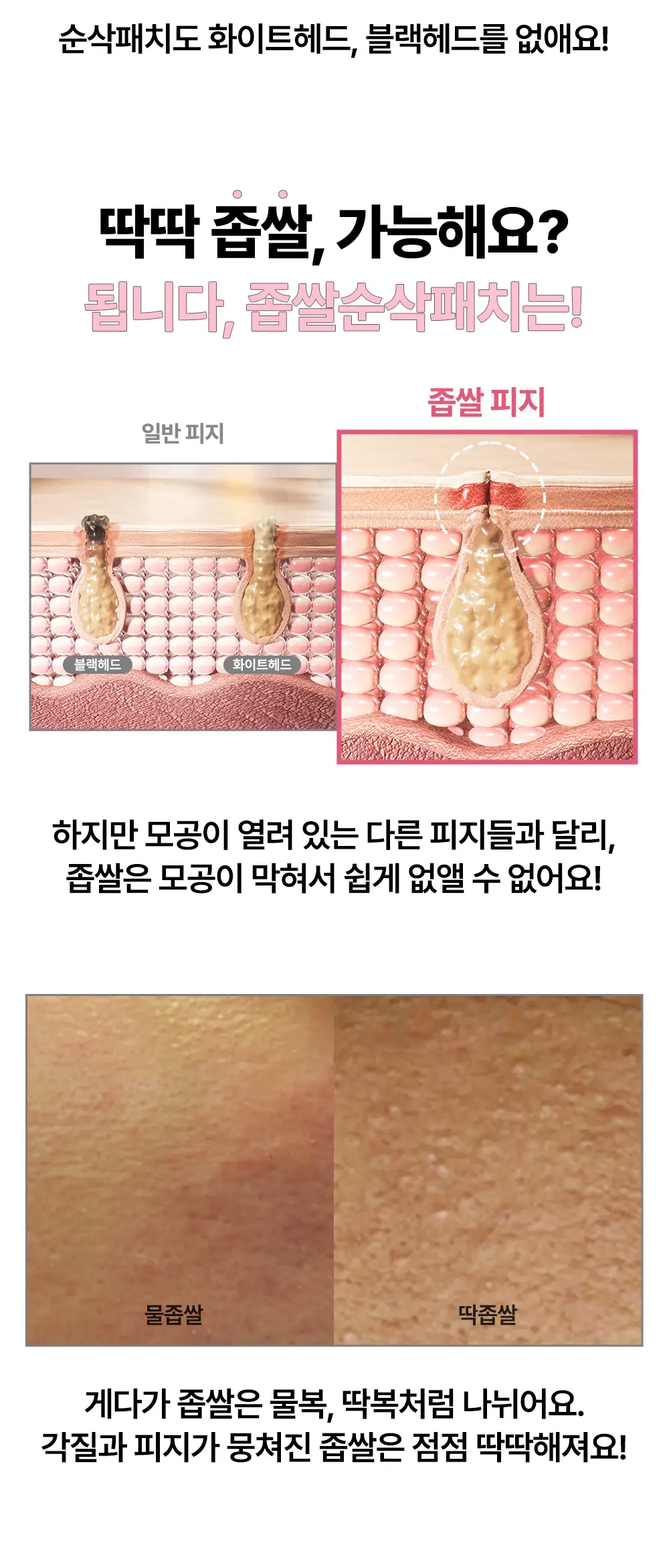 닥터웰메이드원 좁쌀피지 순삭패치 멀티팩 30매 상세페이지 11