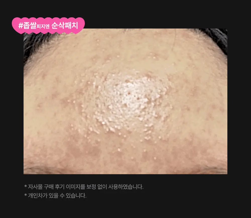 닥터웰메이드원 좁쌀피지 순삭패치 멀티팩 30매 상세페이지 14