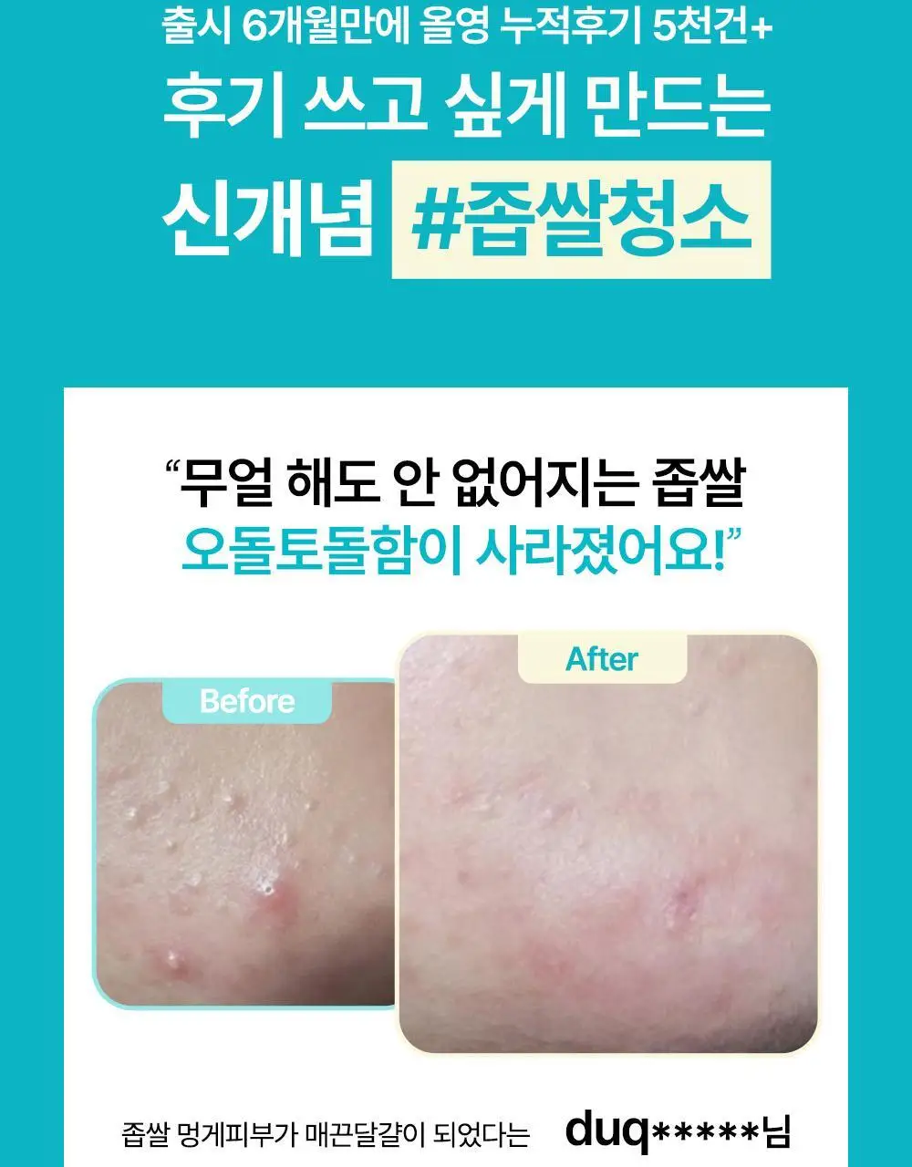 닥터웰메이드원 좁쌀피지 순삭패치 슈퍼마일드 30매 상세페이지 4