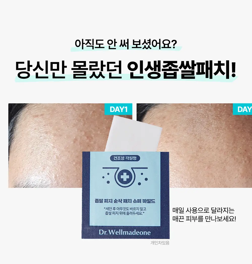 닥터웰메이드원 좁쌀피지 순삭패치 슈퍼마일드 30매 상세페이지 7