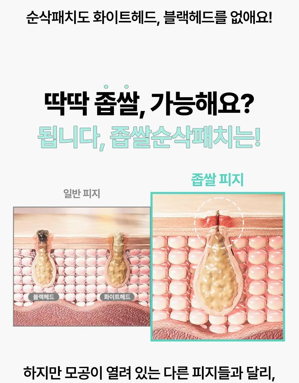 닥터웰메이드원 좁쌀피지 순삭패치 슈퍼마일드 30매 상세페이지 24