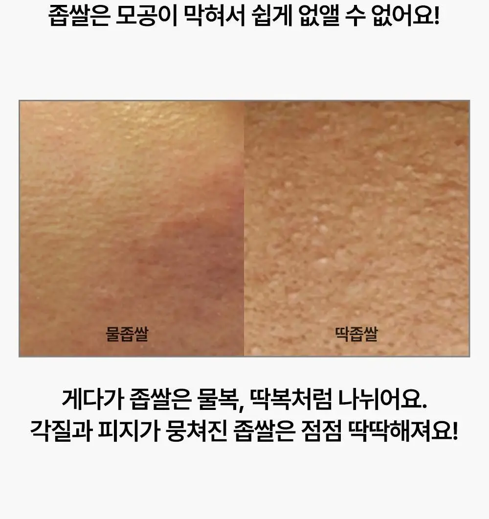 닥터웰메이드원 좁쌀피지 순삭패치 슈퍼마일드 30매 상세페이지 25