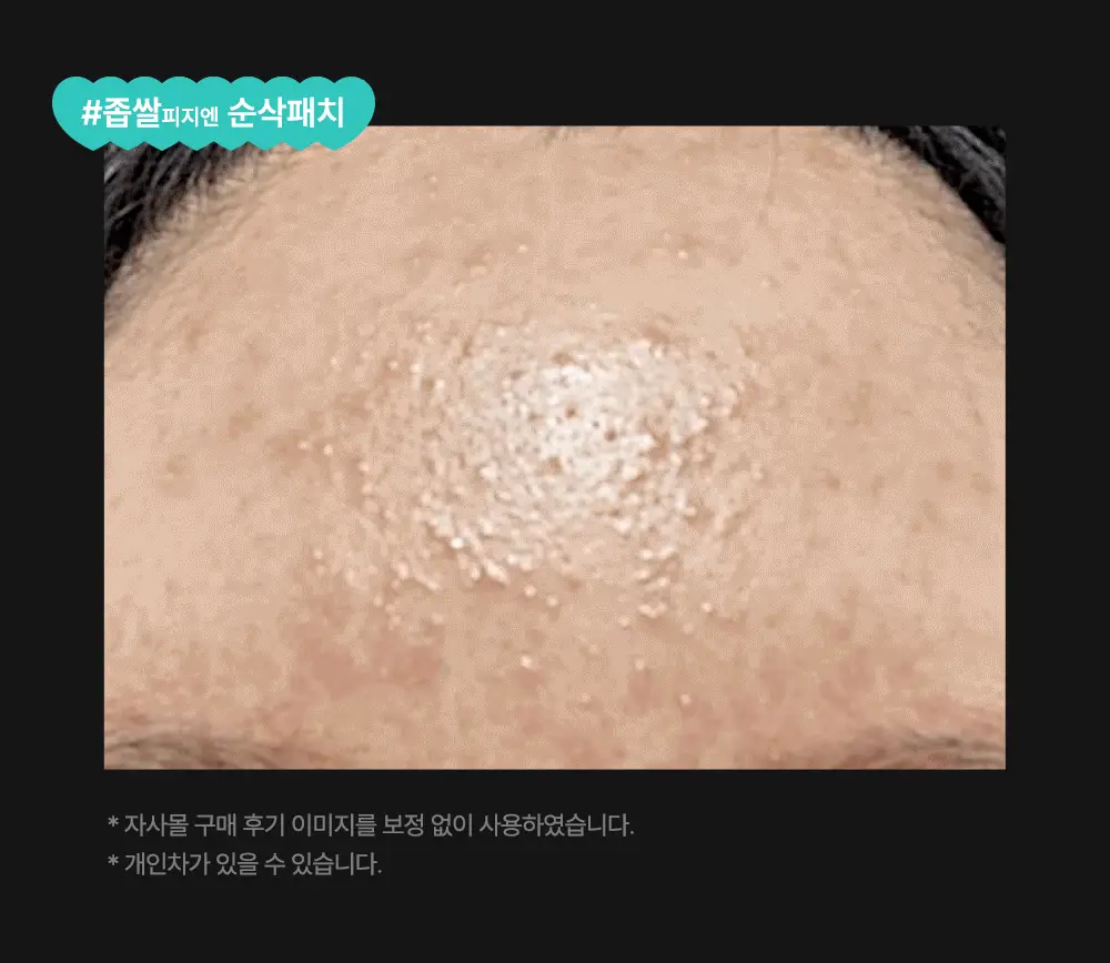 닥터웰메이드원 좁쌀피지 순삭패치 슈퍼마일드 30매 상세페이지 28