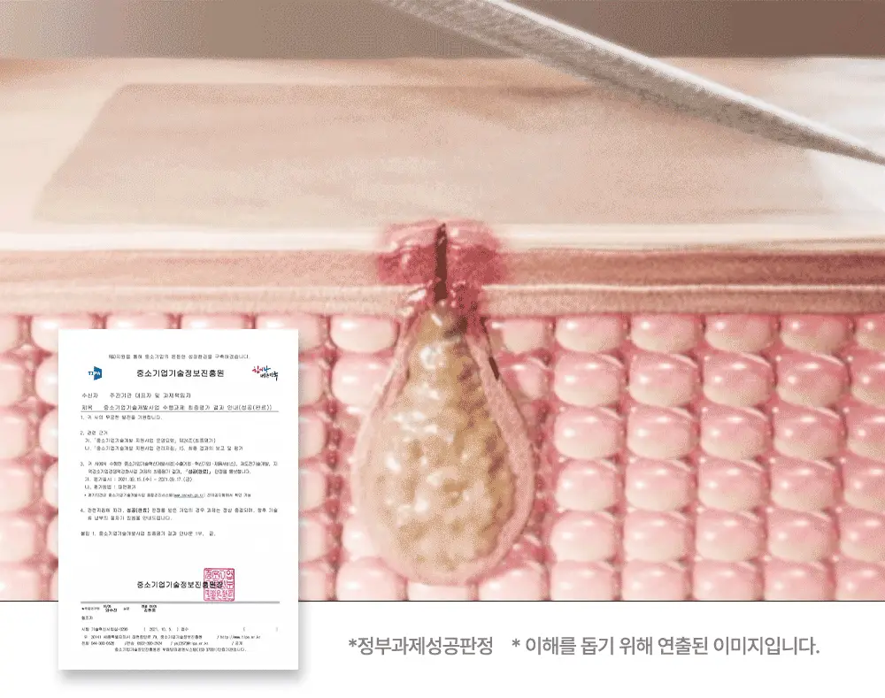 닥터웰메이드원 좁쌀피지 순삭패치 증량 기획 30+10매 2종 택1(마일드/슈퍼마일드) 상세페이지 35