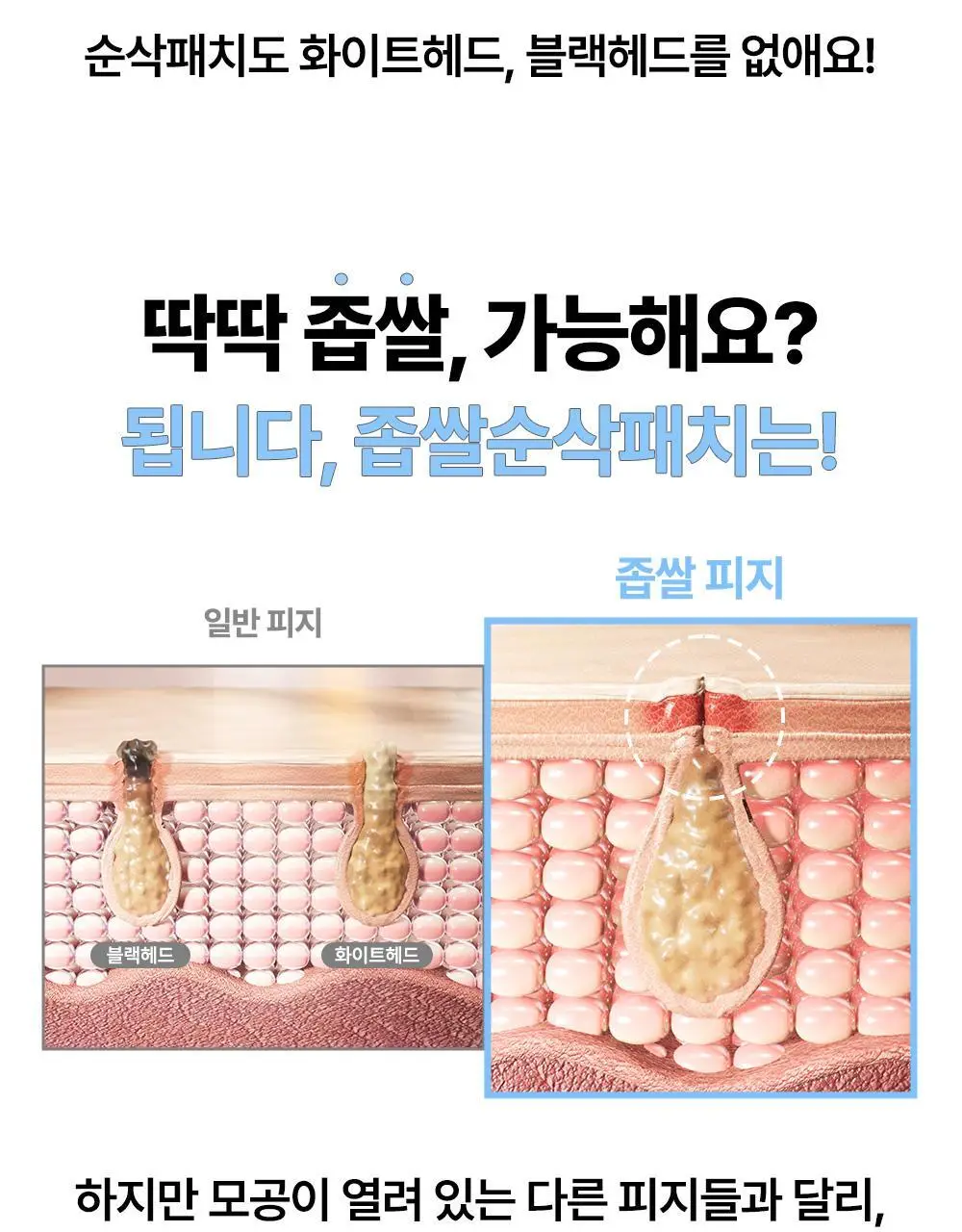 닥터웰메이드원 좁쌀피지 순삭패치 4종 택1(마일드/슈퍼마일드/부스터/멀티팩) 상세페이지 15
