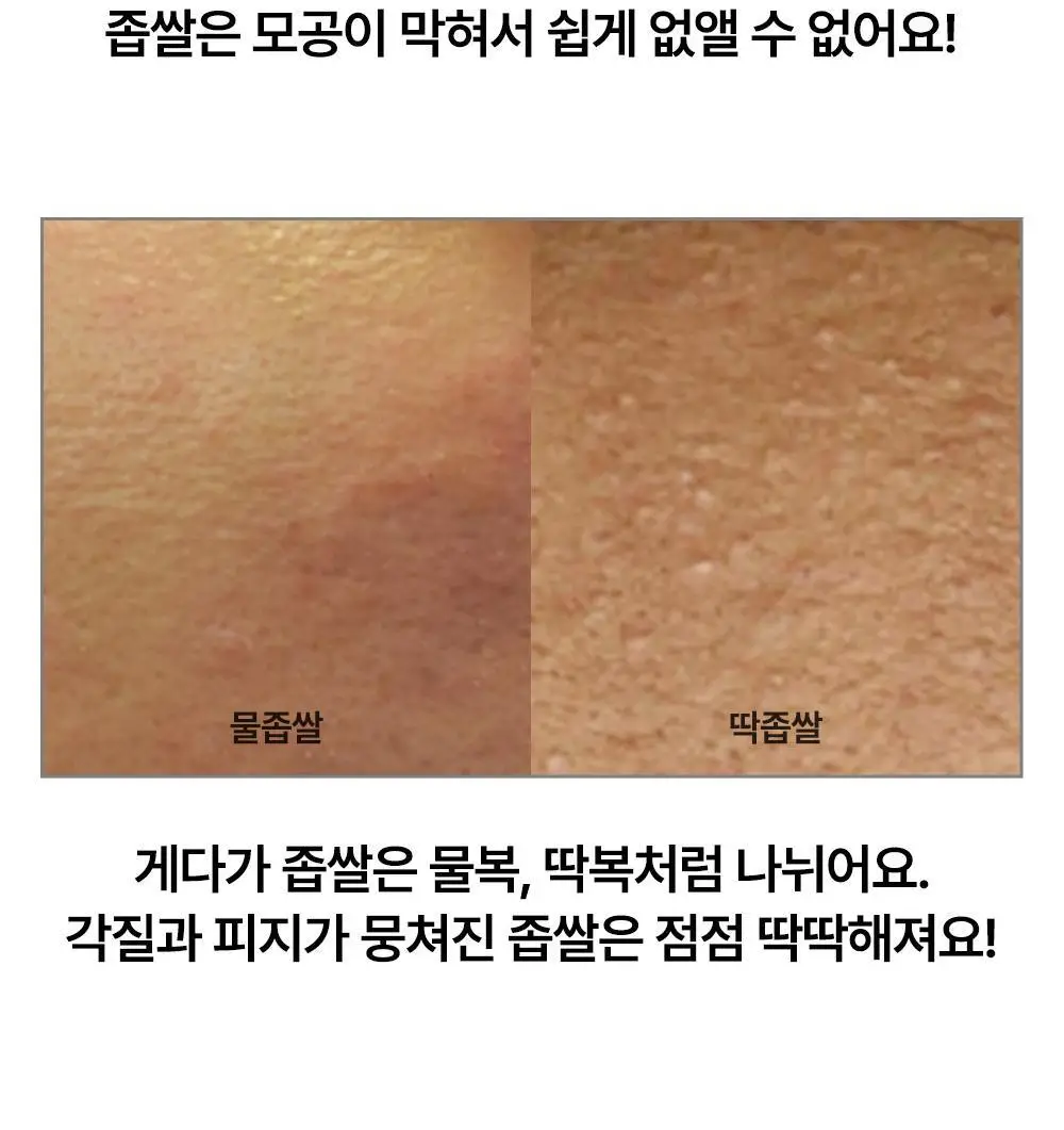 닥터웰메이드원 좁쌀피지 순삭패치 4종 택1(마일드/슈퍼마일드/부스터/멀티팩) 상세페이지 16