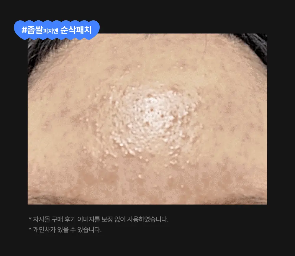 닥터웰메이드원 좁쌀피지 순삭패치 4종 택1(마일드/슈퍼마일드/부스터/멀티팩) 상세페이지 19