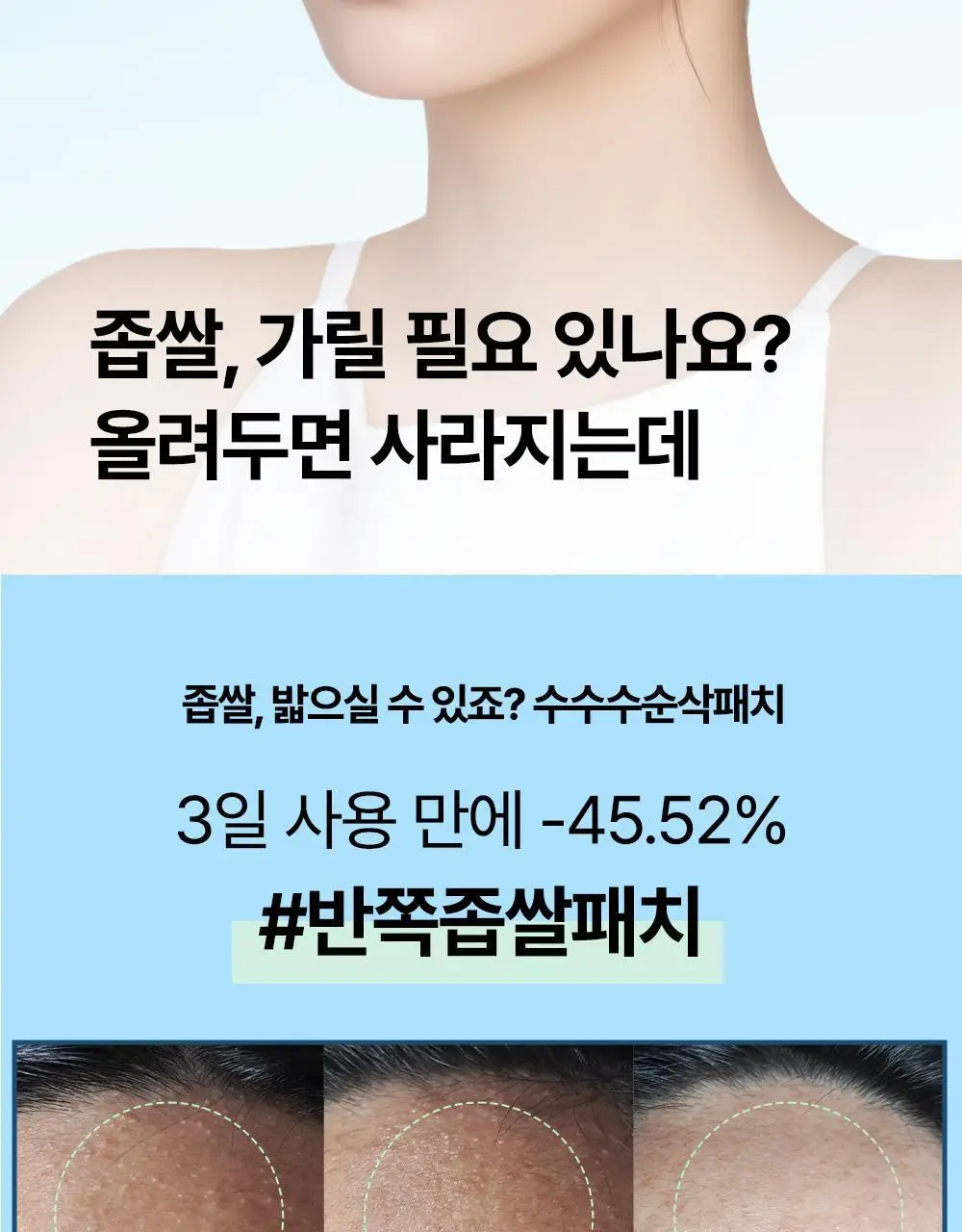 닥터웰메이드원 좁쌀피지 순삭패치 4종 택1(마일드/슈퍼마일드/부스터/멀티팩) 상세페이지 37