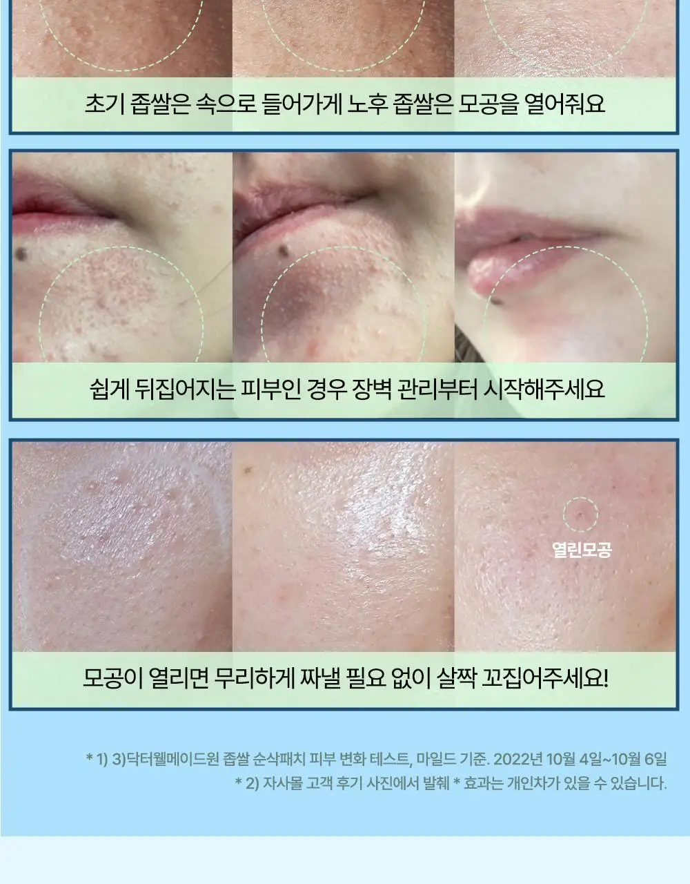 닥터웰메이드원 좁쌀피지 순삭패치 4종 택1(마일드/슈퍼마일드/부스터/멀티팩) 상세페이지 38