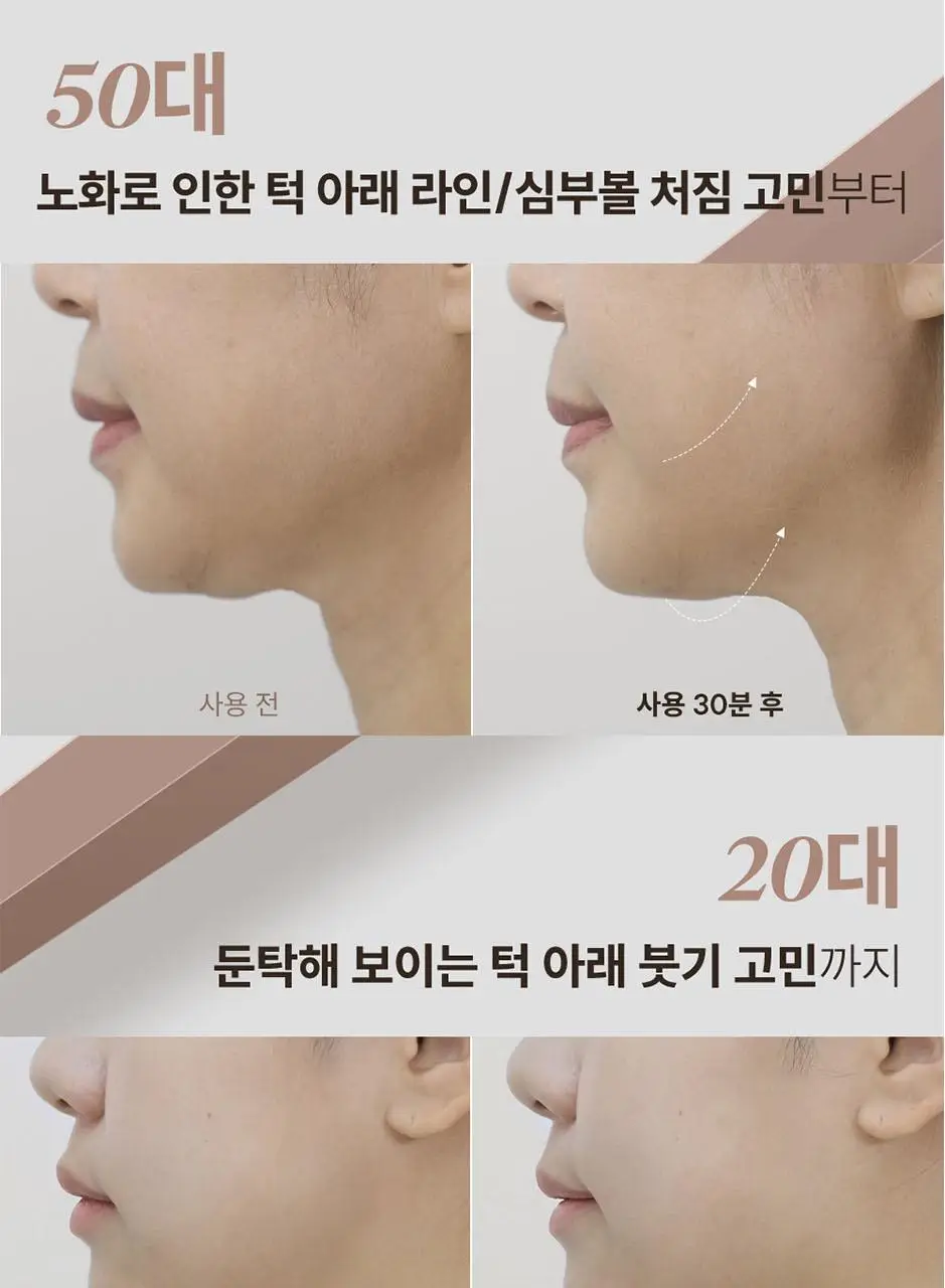 마르시끄 라인 리프팅 하이드로겔 턱선 패치 3매(1개) 상세페이지 11