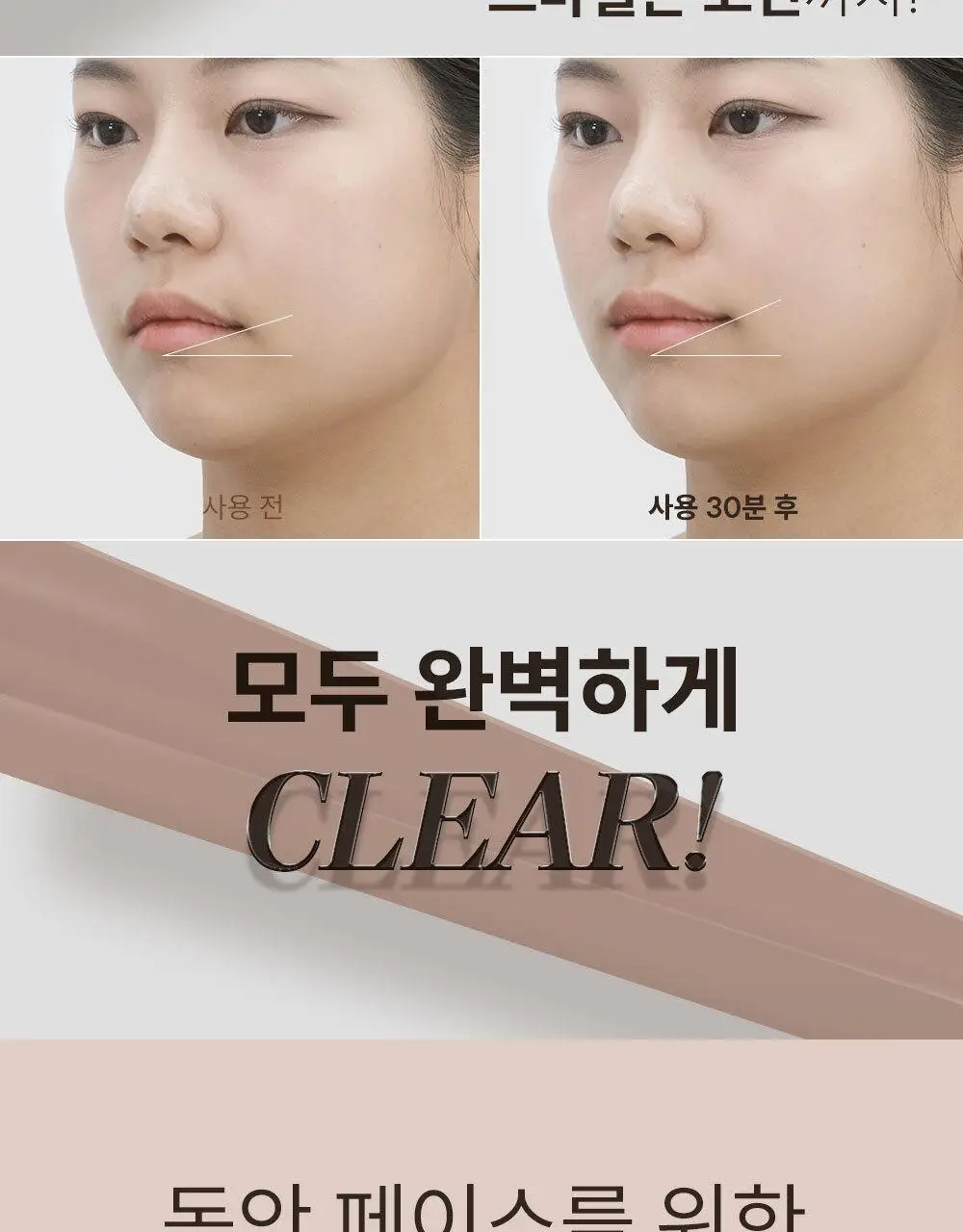 마르시끄 라인 리프팅 하이드로겔 패치 2종 택1 (입꼬리/턱선) 상세페이지 16