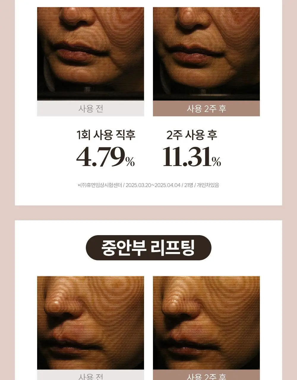마르시끄 라인 리프팅 하이드로겔 패치 2종 택1 (입꼬리/턱선) 상세페이지 18