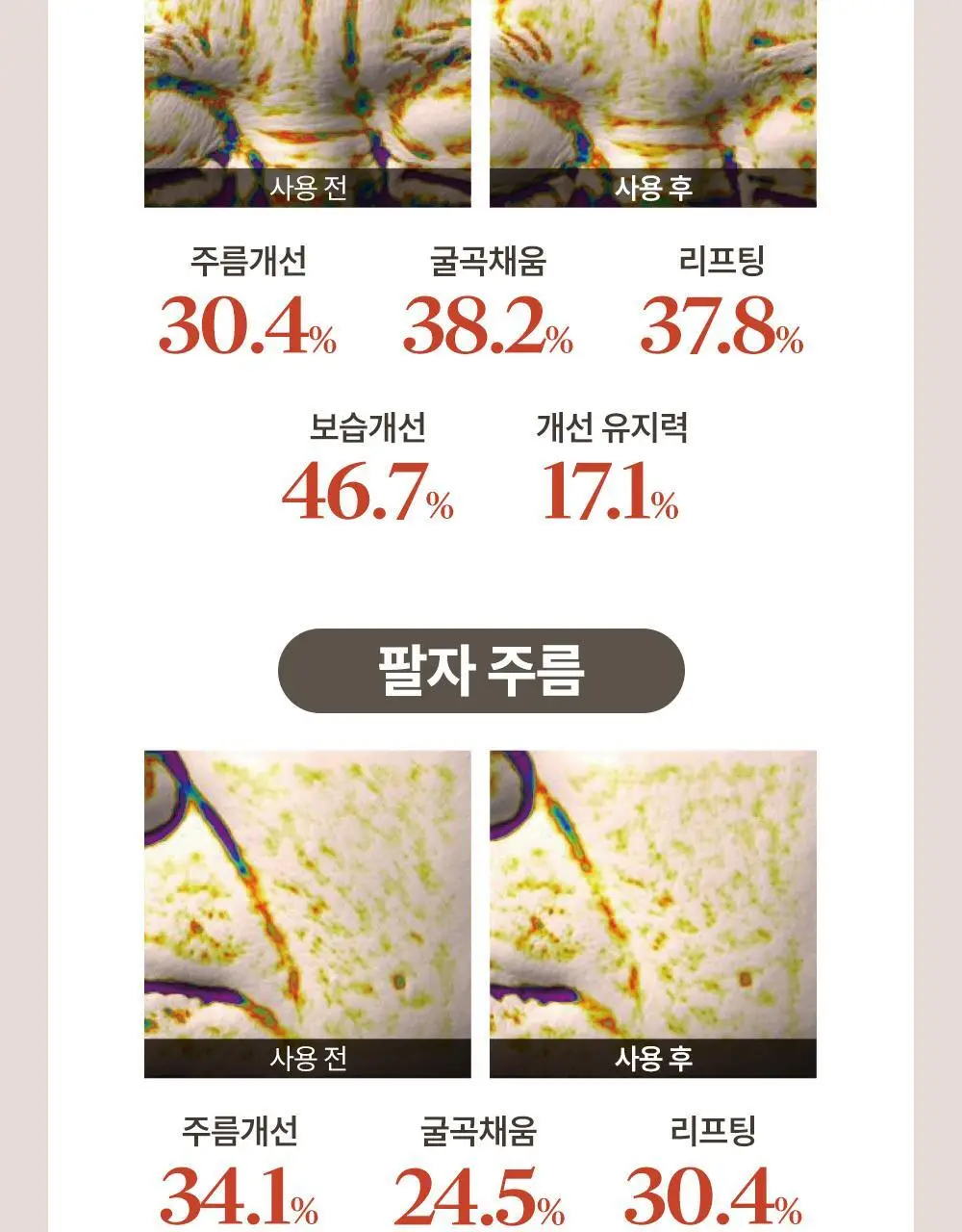 마르시끄 링클 리페어 이마 주름패치 15매(1개) 상세페이지 8