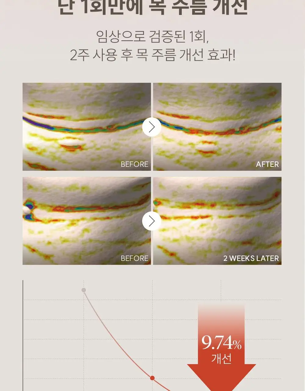 마르시끄 링클 리페어 하이드로겔 넥패치 4매(1개) 상세페이지 7