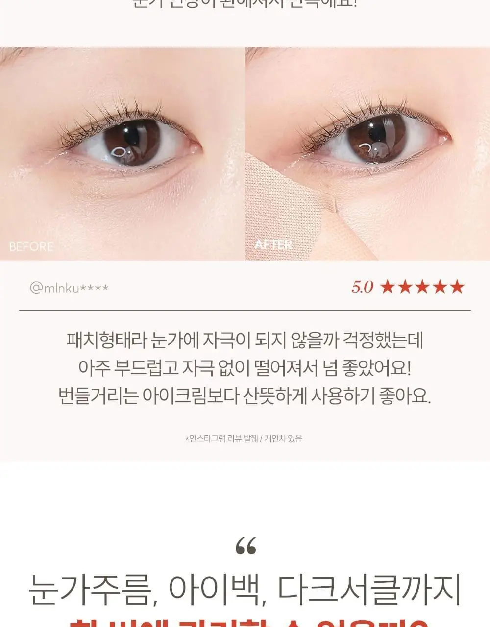 마르시끄 주름패치 기획/단품 7종 택1 상세페이지 32