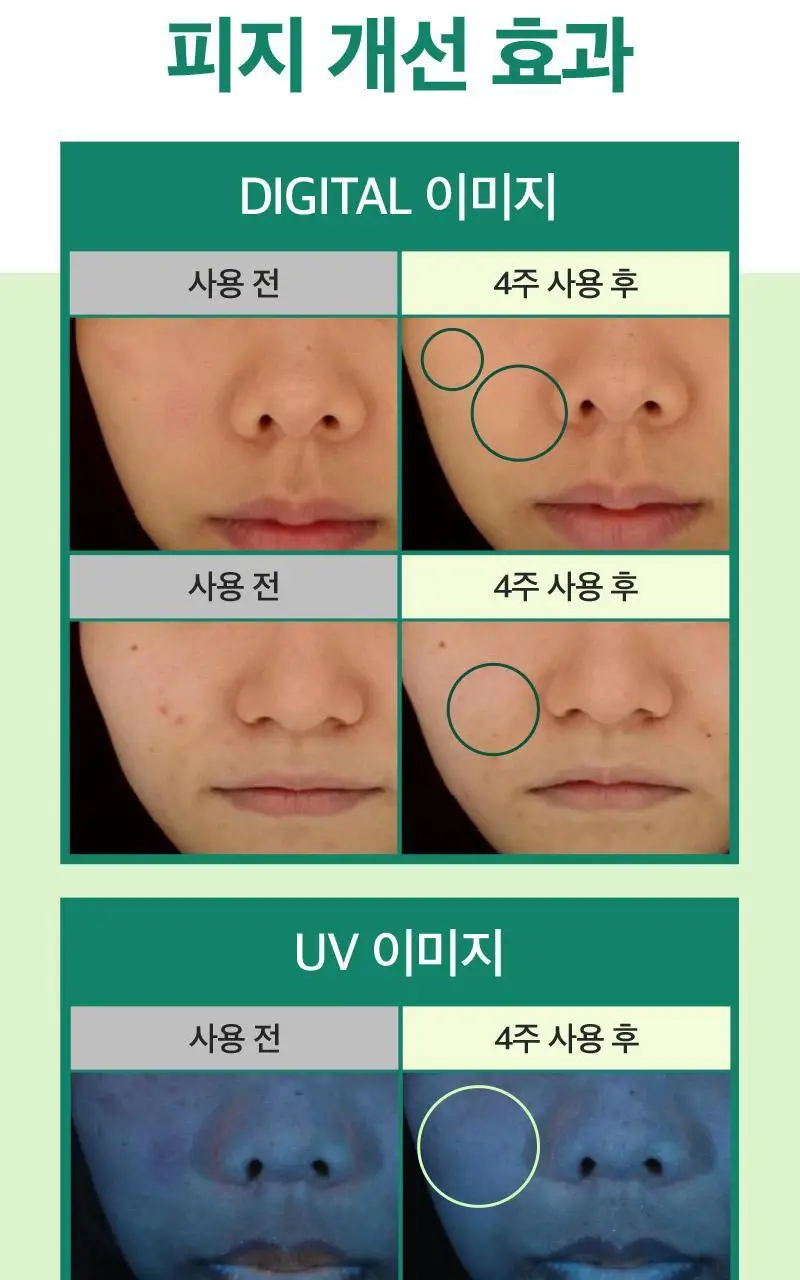 메디필 에이씨 티 클리어 50ml 상세페이지 9
