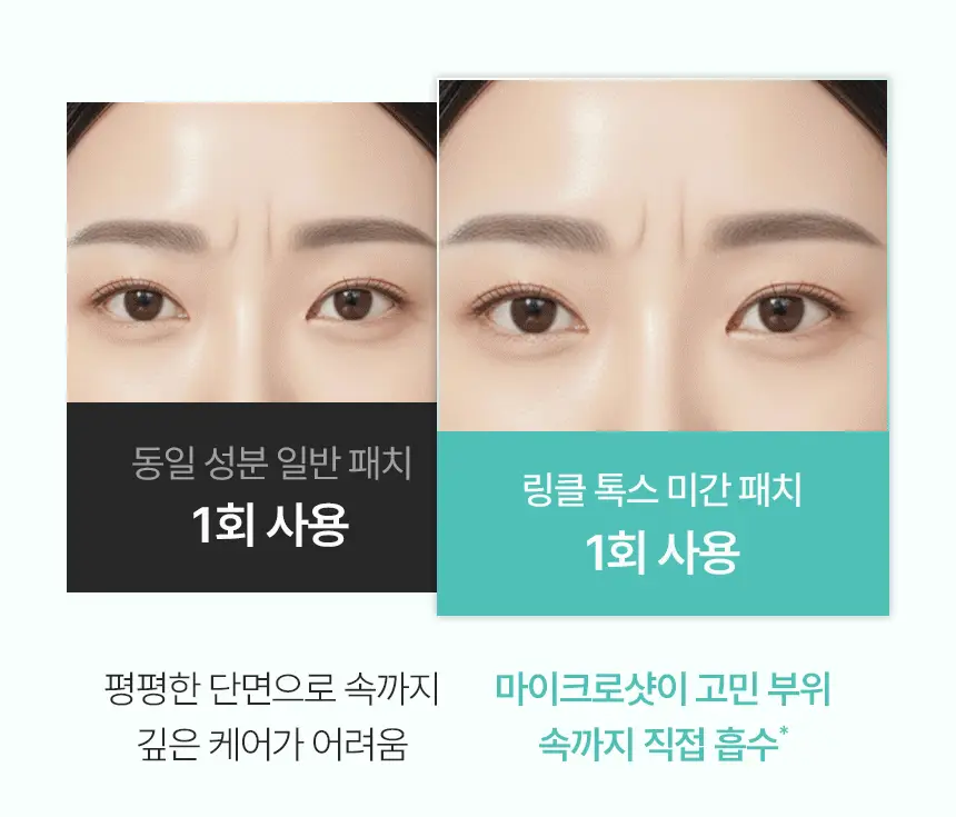 샤르드 링클 톡스 미간패치 3매입 상세페이지 10