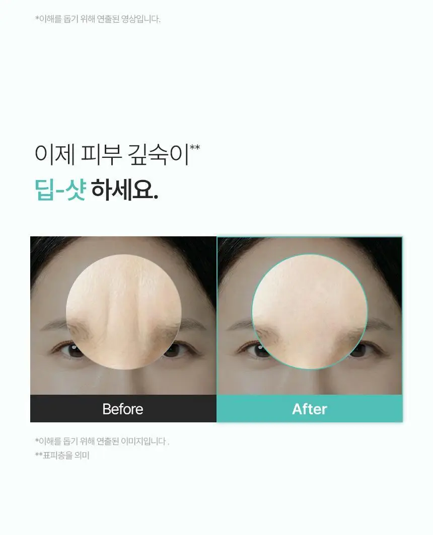 샤르드 링클 톡스 미간패치 3매입 상세페이지 26