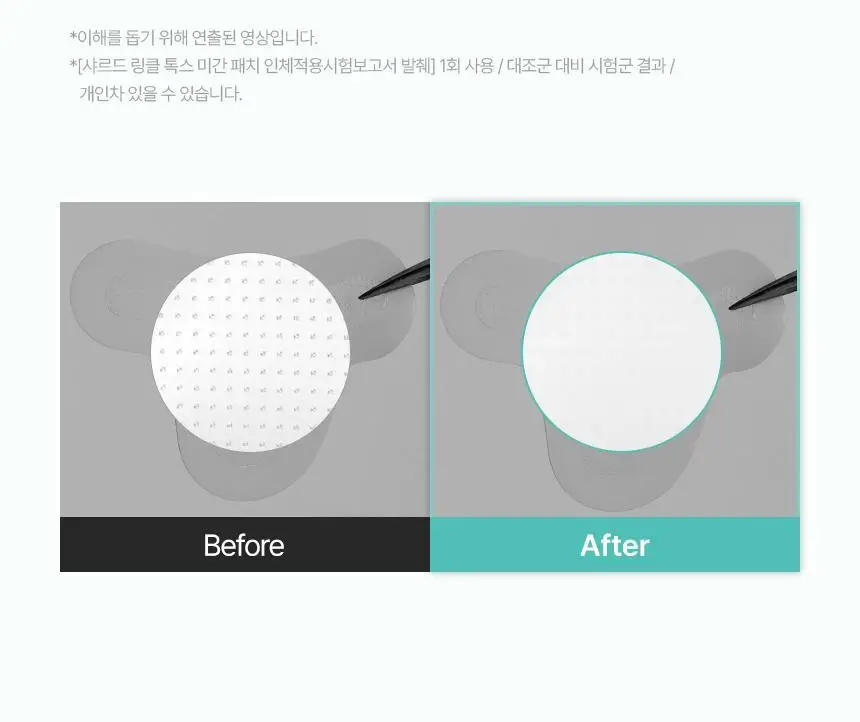 샤르드 링클 톡스 미간패치 3매입 상세페이지 35