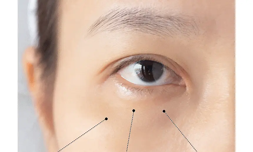샤르드 1100샷 아이백 리프트 패치 단품/1+1 기획 상세페이지 11