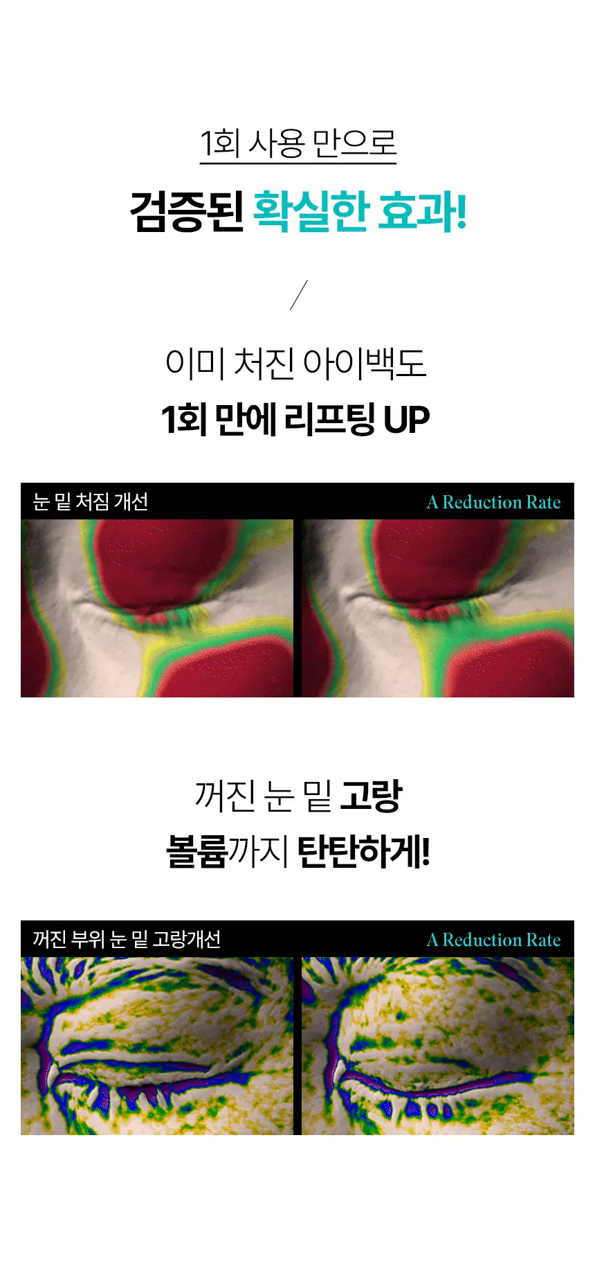 샤르드 1100샷 아이백 리프트 패치 2+1 기획/단품 상세페이지 21