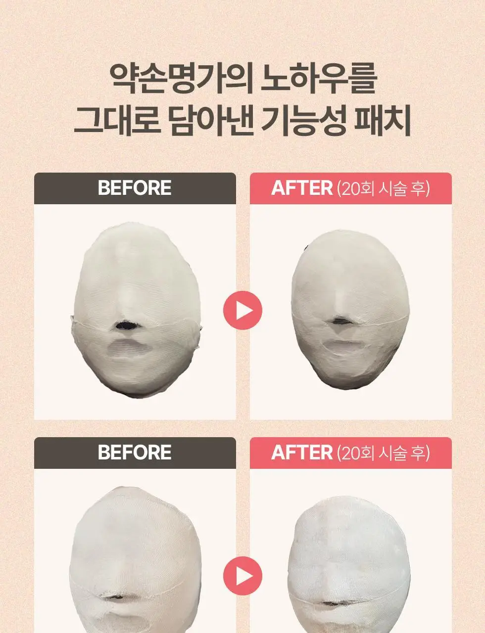 약손명가 브이한 리프팅 패치(PDRN 10K) 5매입 상세페이지 6